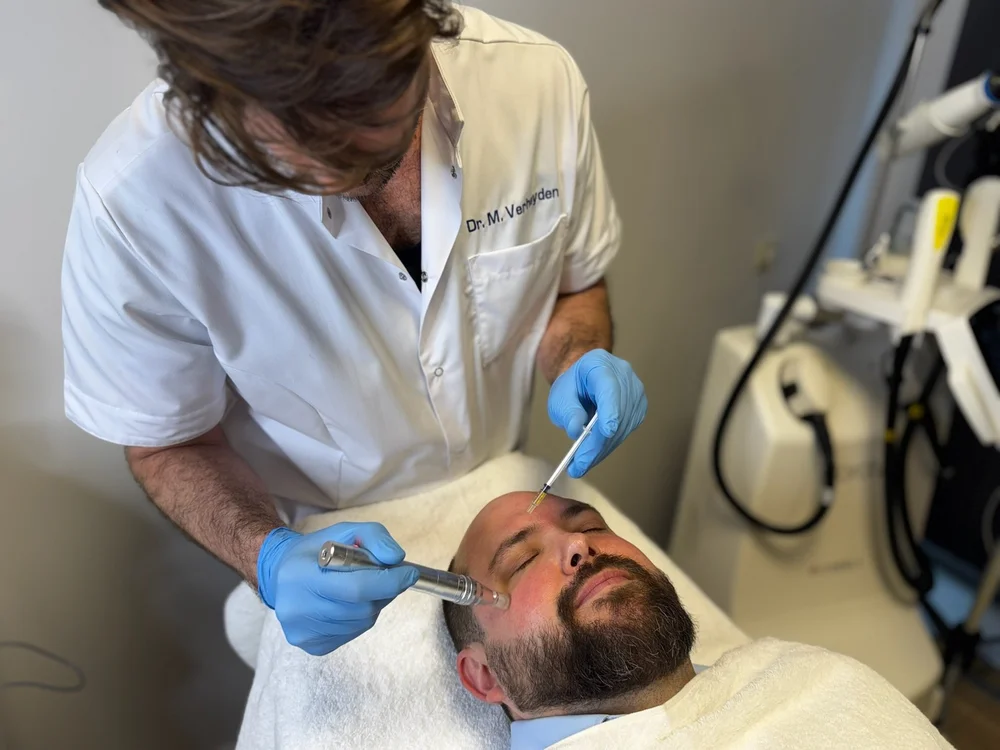 Microneedling